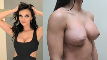 Brittney Atod Nude Boob Job moderno